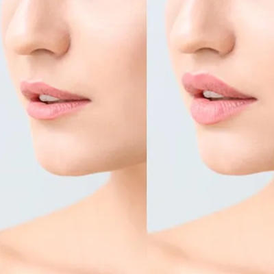 lip lip